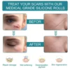 Silicone Scar Tape Skin Cover & Repair - Image 11